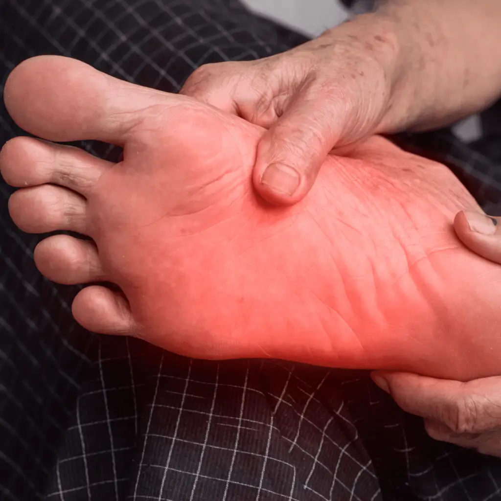 foot with redness indicating numbness or tingling.